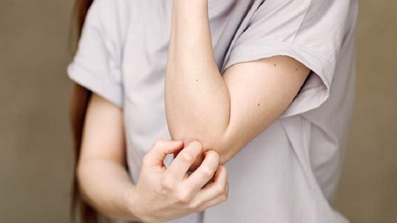 صورة تعبيرية 