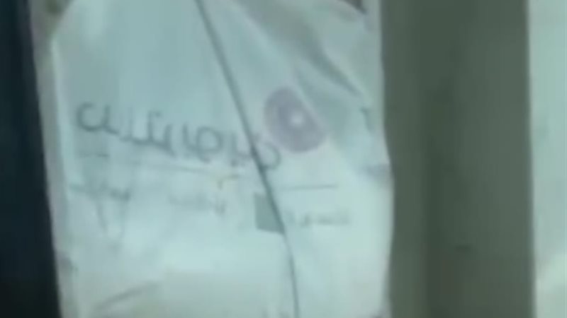 طفلة رضيعة بالكيس