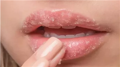 ودعي مستحضرات التجميل.. طرق معرفة أسباب تشقق الشفاه وكيفية ترطيبها بسهولة 