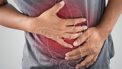 القولون العصبي مرض نفسي أم عضوي؟.. حسام موافي يوضح الحقيقة وأسباب الإصابة