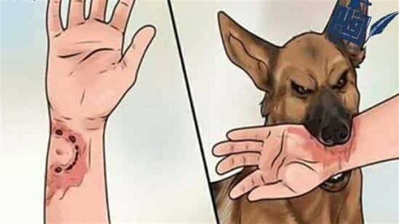 مرض السعار