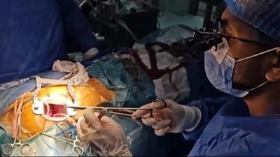 لأول مرة.. إنجاز طبى جديد لفريق بجراحة القلب والصدر من جامعة أسيوط