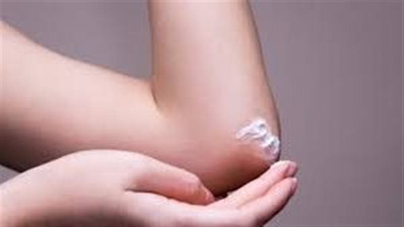 علاج اسمرار الكوع 