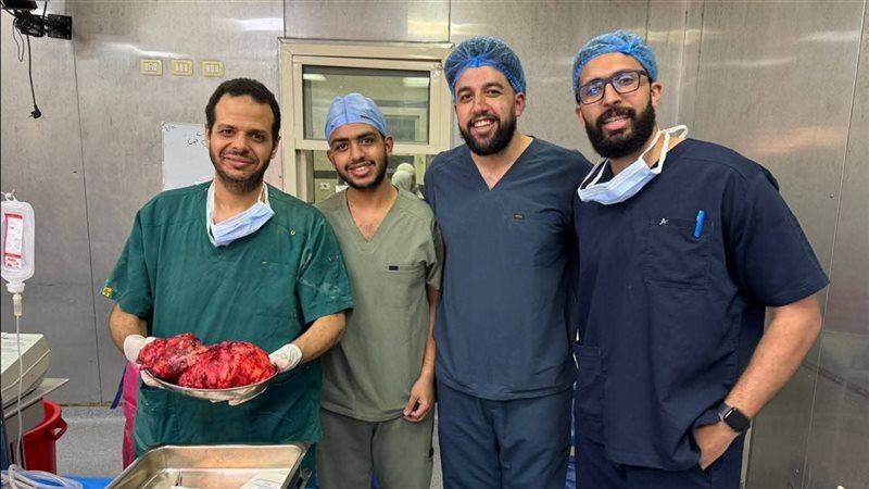 الفريق الطبى بعد استئصال الورم