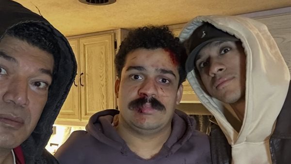 عصام عمر وأحمد بيلا
