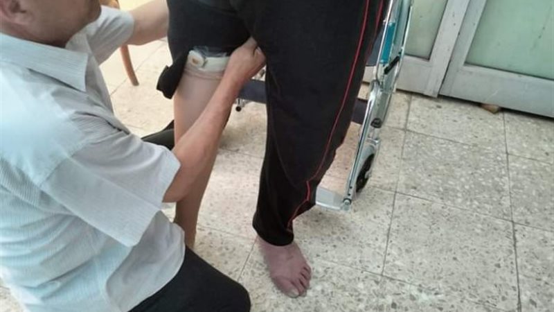 اجهزه تعويضية